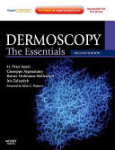Dermoscopy