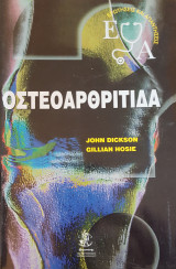 Οστεοαρθρίτιδα Ερωτήσεις και Απαντήσεις