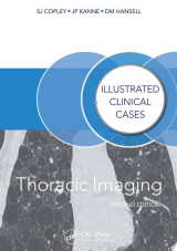 Thoracic Imaging