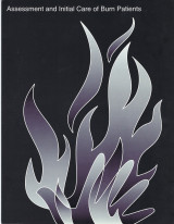 Assessment and Initial Care of Burn Patients