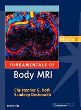 Fundamentals of Body MRI, Edition 2