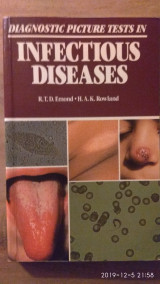 Diagnostic Picture Tests in Infectious Diseases