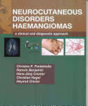 Neurocutaneous Disorders Haemangiomas