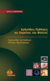 Καλοήθεις παθήσεις και καρκίνος του μαστού